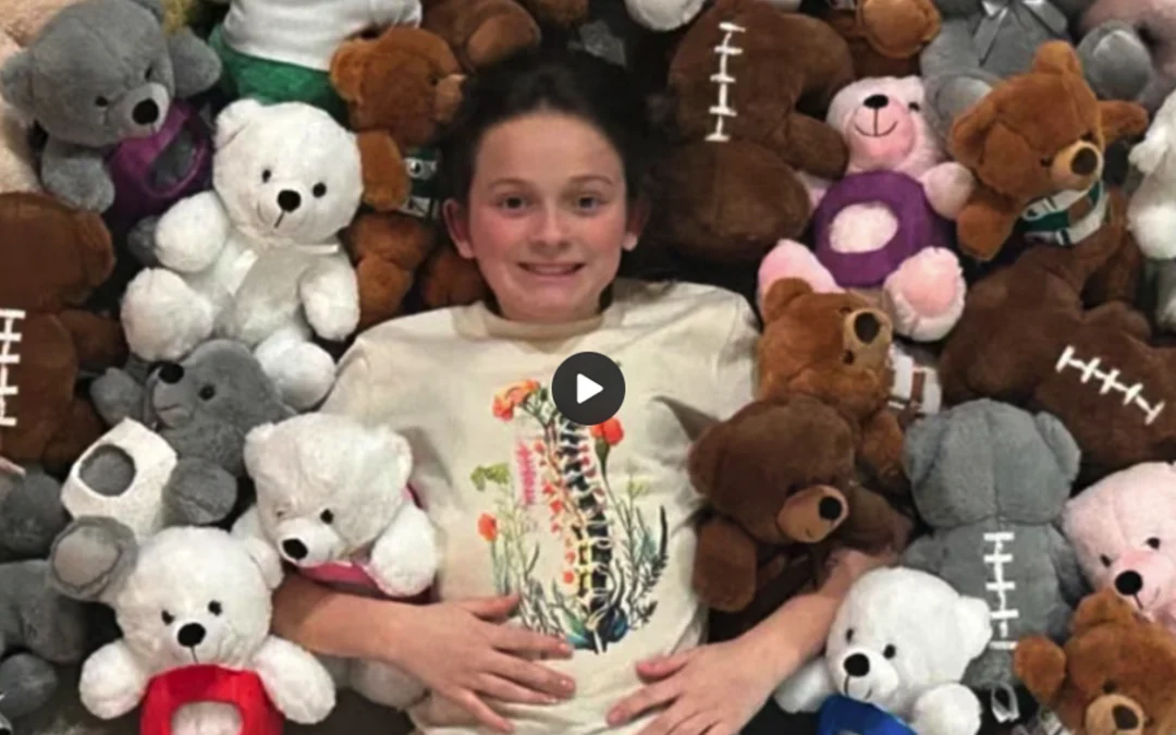 Teen Creates Teddy Bears for Kids with Scoliosis